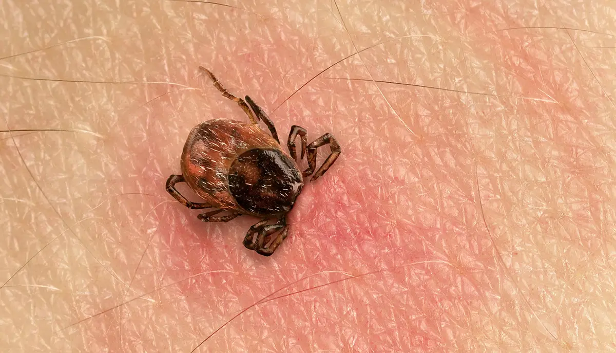 Tick Bites 101